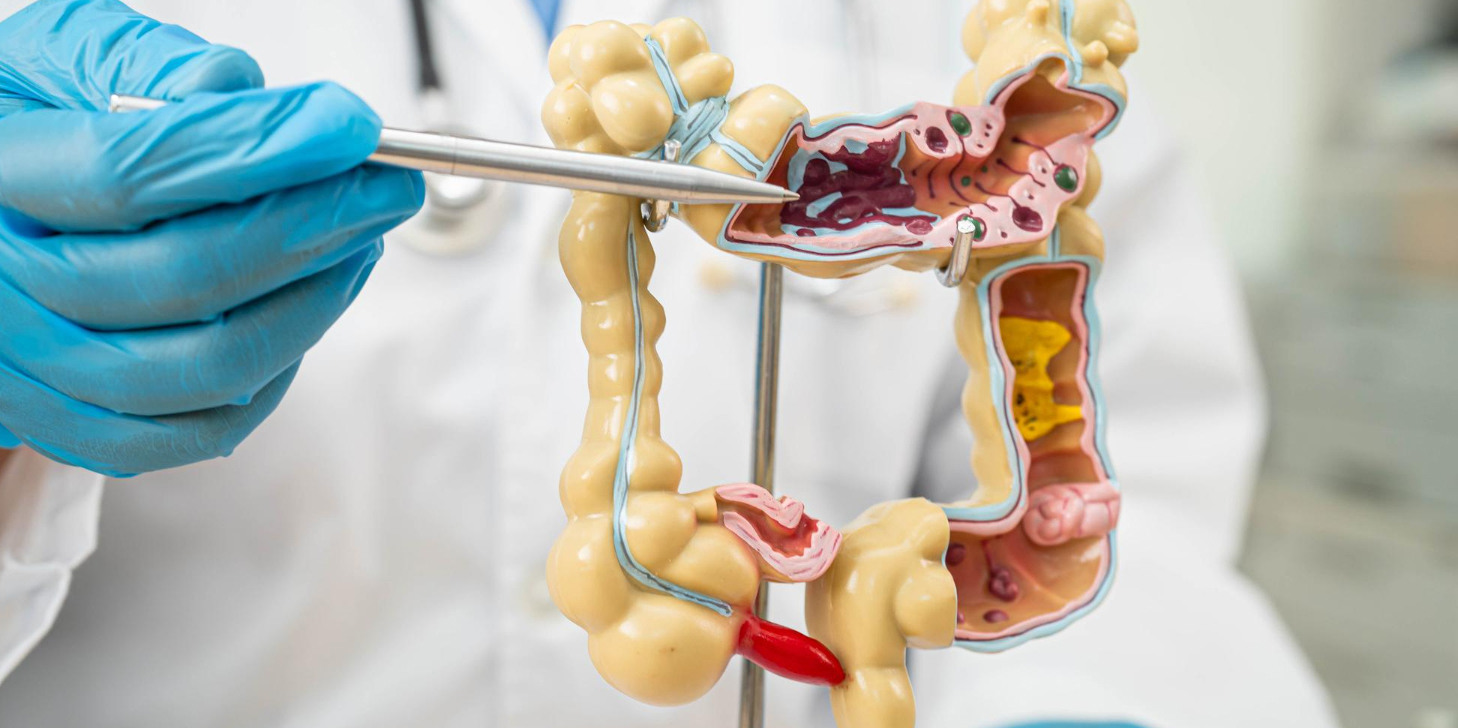 Colorectal Surgery